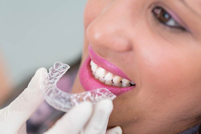 Orthodontic Treatments for Adults. Dental Clinic Marbella.