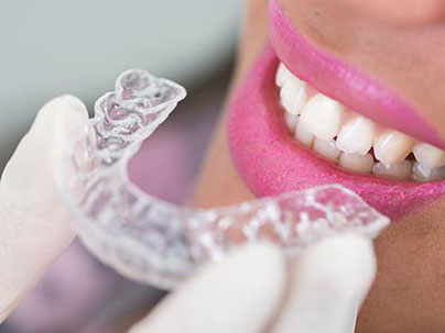 Ortodoncia - tratamientos malposiciones dentales Clínica Dental San Pedro, Marbella